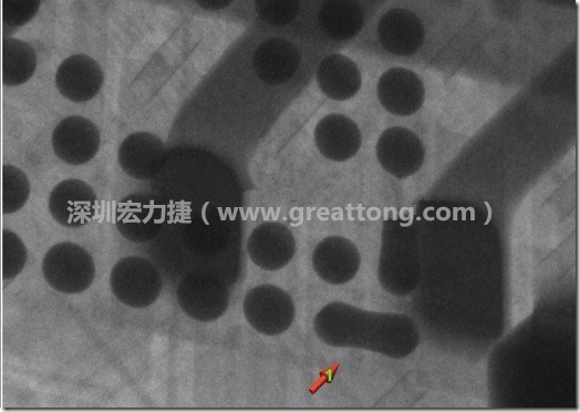 BGA因为焊垫变小，造成锡膏过多而最终形成焊接短路的结果。